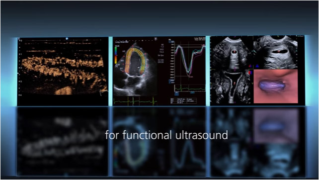 siêu âm Canon Medical (Toshiba)